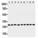 Peroxiredoxin 3 Antibody