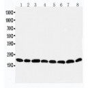 Peroxiredoxin 5 Antibody