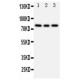 PI 3 Kinase p85 beta Antibody