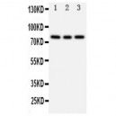 PI 3 Kinase p85 beta Antibody