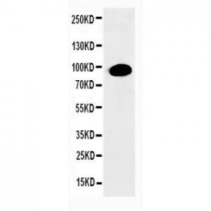 PKC alpha Antibody