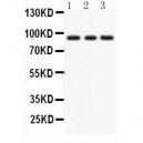 PKC epsilon  Antibody