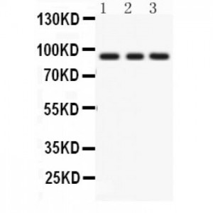 PKC epsilon  Antibody