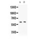 PKLR  Antibody