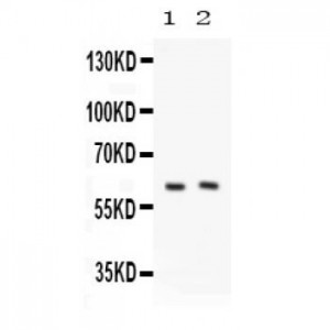 PKLR  Antibody