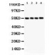 PKM2  Antibody