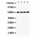 PKM2  Antibody