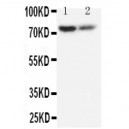 PMP70 Antibody