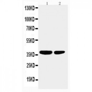 PP2A Antibody