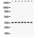 PP2A-alpha  Antibody