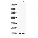 Prealbumin  Antibody