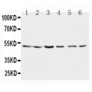 Presenilin 2 Antibody