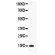 Profilin 2 Antibody