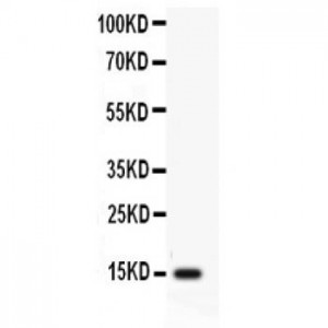 Profilin 2 Antibody