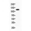 Progesterone Receptor Antibody