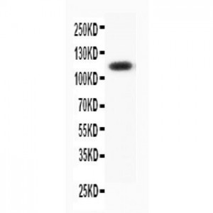 Progesterone Receptor Antibody