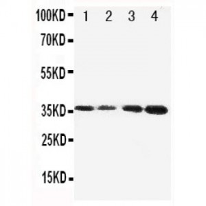 Protein C Antibody