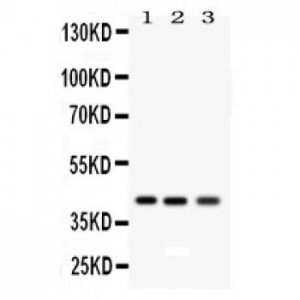 RAGE  Antibody