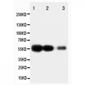 RAGE Antibody