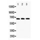 RANK Antibody