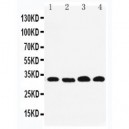 REA Antibody