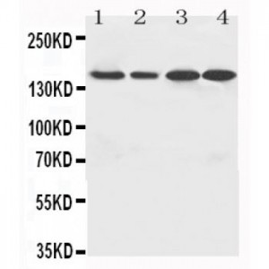 ROCK2 Antibody