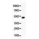 RUNX1/AML1  Antibody