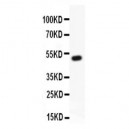 RUNX1/AML1  Antibody