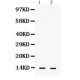 S100A9  Antibody