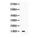 S100A9  Antibody