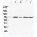 SDHA Antibody