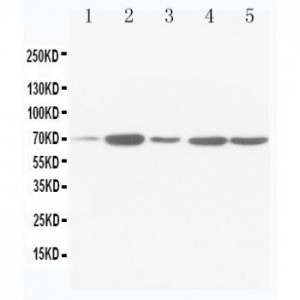 SDHA Antibody