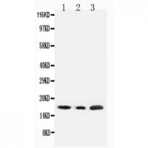 SDHC Antibody