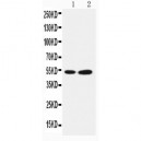 Selenium Binding Protein 1 Antibody