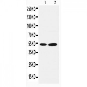 Selenium Binding Protein 1 Antibody