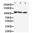 SERCA1 ATPase Antibody