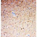 Serotonin transporter Antibody