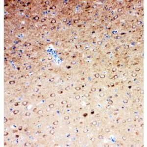 Serotonin transporter Antibody