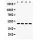 SERPINA1  Antibody