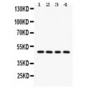 SERPINA1  Antibody