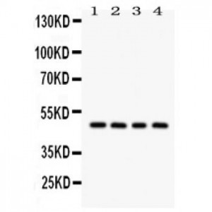 SERPINA1  Antibody