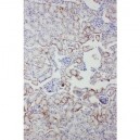 Serum Amyloid P  Antibody