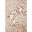 Serum Amyloid P  Antibody