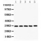 SF2  Antibody