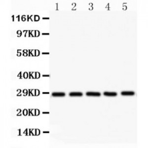 SF2  Antibody