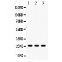 SFTPA1/2  Antibody