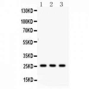 SFTPA1/2  Antibody