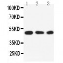 SGK1 Antibody