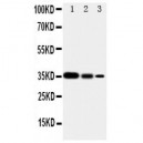 SHC Antibody