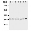 SIAH Interacting Protein Antibody